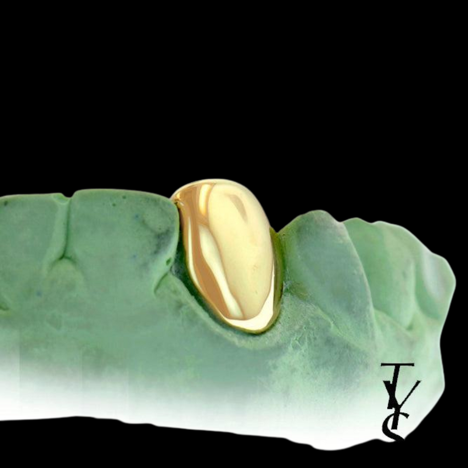 Single Tooth Sterling Silver Grillz