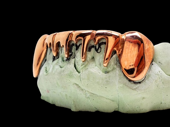 Custom Grillz 925 Solid Sterling Silver Dripping Style Grillz (Yellow Rose Silver)