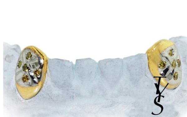 2 Gold Fang Teeth With Diamonds - Image 2