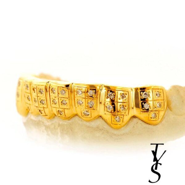 Custom Pave Set Grillz - Image 2