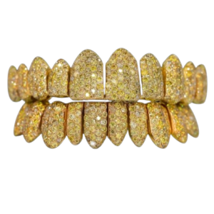 Canary Yellow VVS Moissanite Diamond Grillz