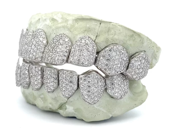 VVS Moissanite Diamond Grillz - Image 2