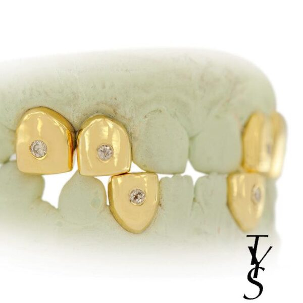 18k INDIVIDUAL Pave Set Diamond Teeth Grillz - Image 2