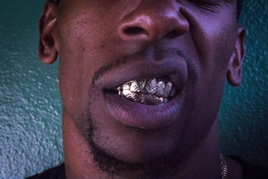 Custom Grillz Are the Hottest Trend